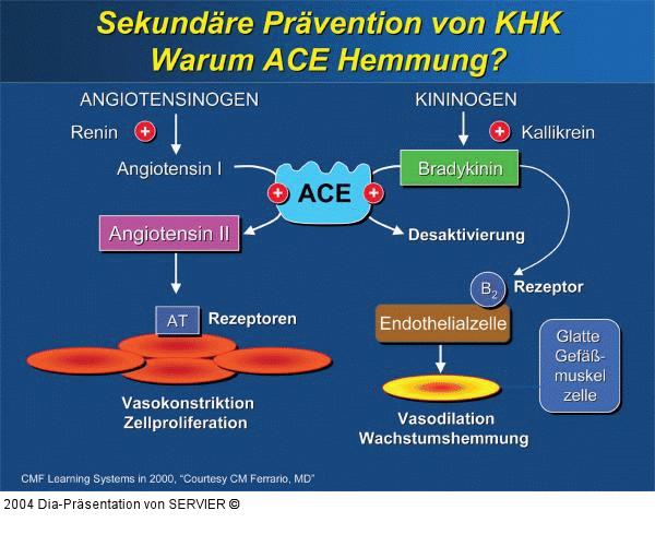 KHK - Sekundärprävention