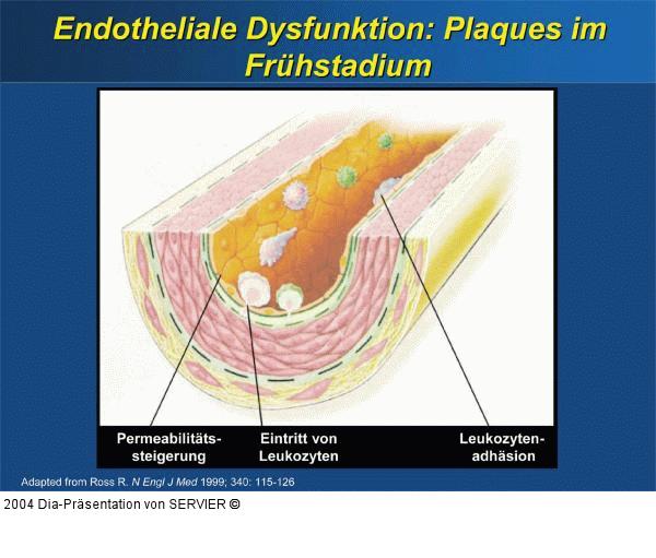 Endotheliale Dysfunktion