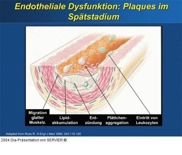 Endotheliale Dysfunktion