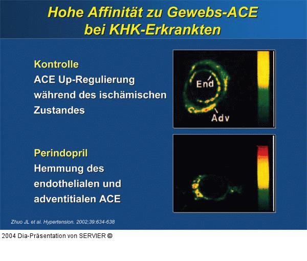Perindopril - Gewebs-ACE