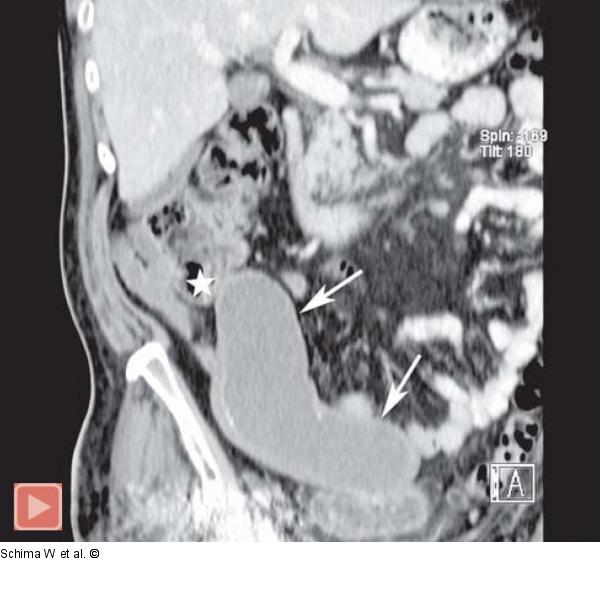 MDCT- 3D-Rekonstruktion