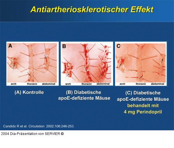 Perindopril - Antiatheriosklerotischer Effekt