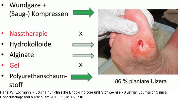 Diabetisches Fußsyndrom