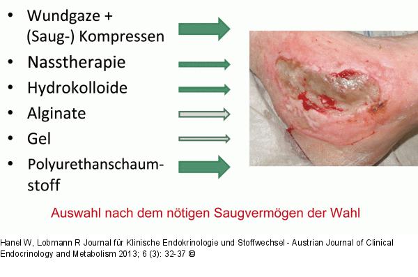 Diabetisches Fußsyndrom