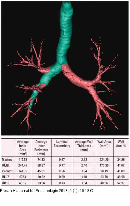Computertomographie-COPD