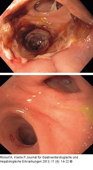 Darmfunktionsstörungen-Diagnostik