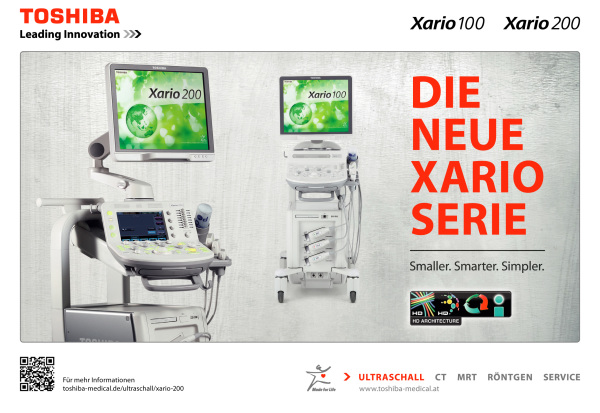 Produkt: Xario 100<br>Vertrieb: Toshiba Medical Systems GmbH 