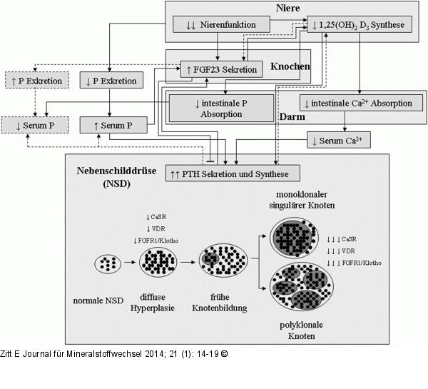 Sekundärer Hyperparathyreoidismus
