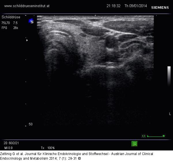 Video 5 - Linker Lappen