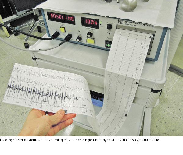 Elektrokonvulsionstherapie