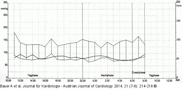 Blutdruck-Stundemittelwerte