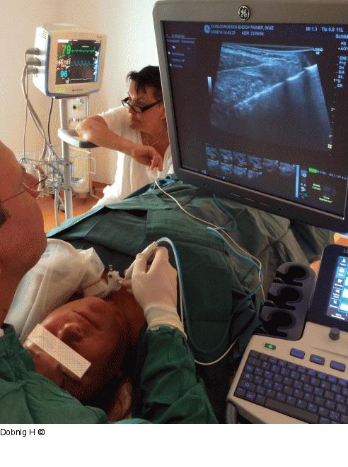 Alkoholablation - Schilddrüse