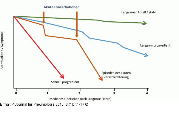 Idiopathische pulmonale Fibrose