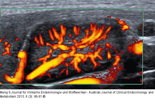 Lymphknoten-Ultraschall
