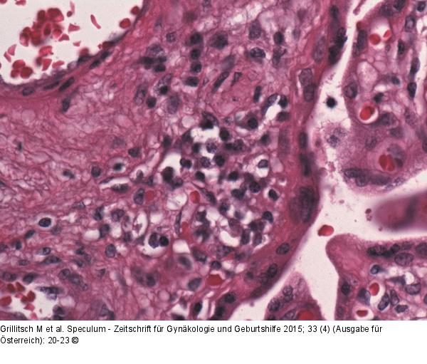Histopathologie-Plazenta