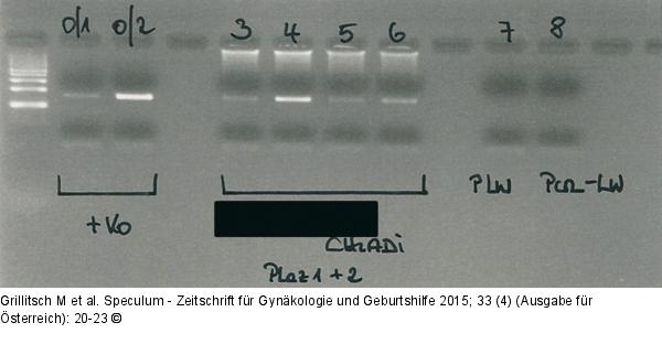CMV-PCR-Banden