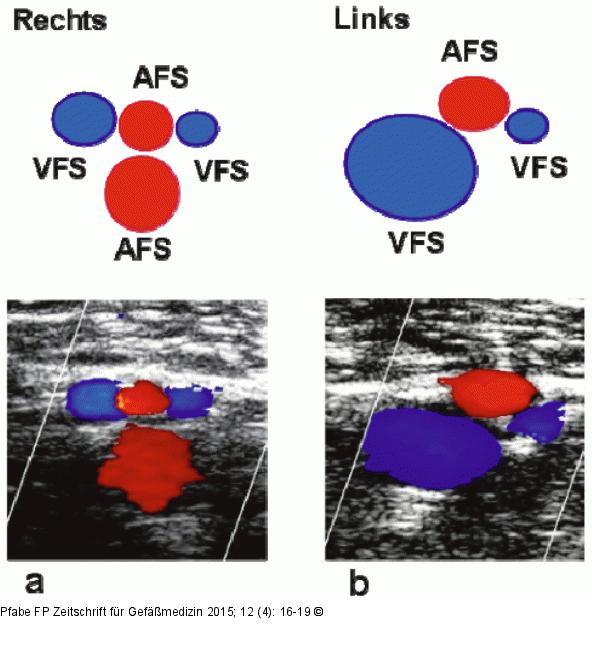 Oberschenkelgefäße
