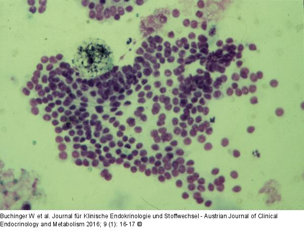 Zytologie - Schilddrüse