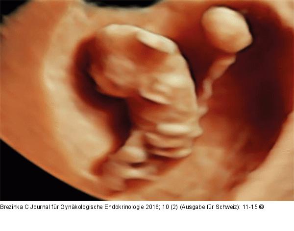 Ultraschall-Dottersack