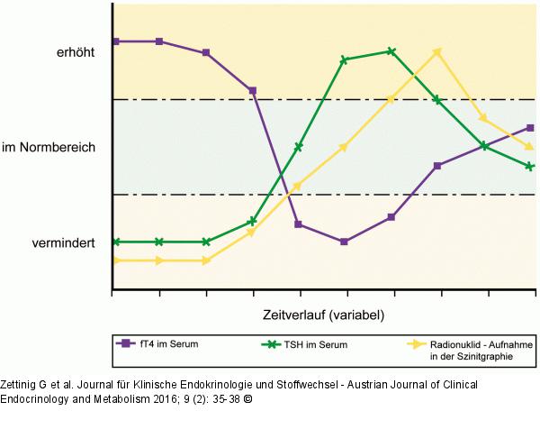 Thyreoiditis-Schilddrüsenfunktion