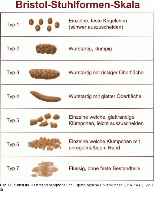 Bristol-Stuhlformen-Skala