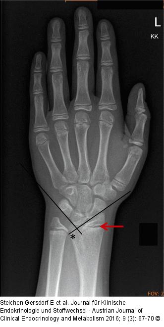 Radiologische Zeichen