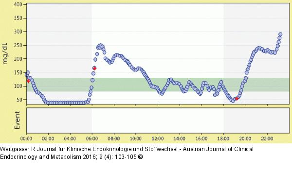 Nächtliche Hypoglykämie