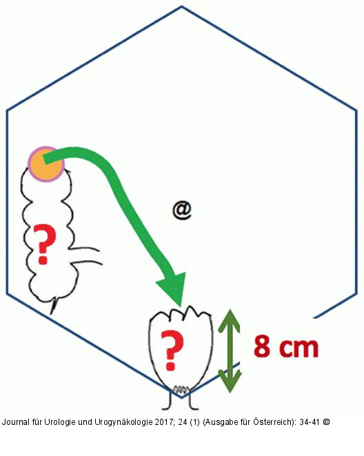 Intestinale Rekonstruktion