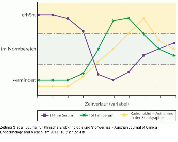 Schematischer Verlauf