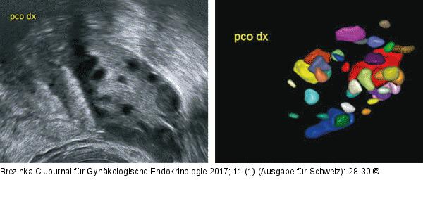 Volumen-Messmethoden