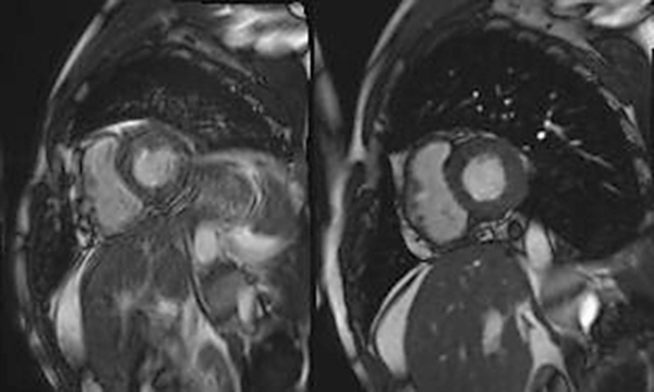 Produkt: MRT-Scan<br> Vertrieb: Siemens Healthcare
