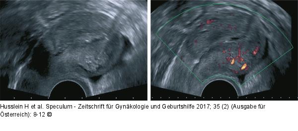 Typische Ultraschallmerkmale