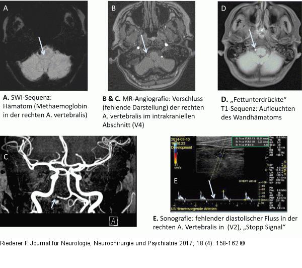 Bildgebungsmodalitäten