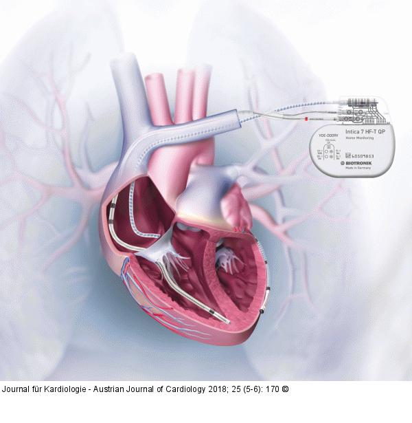 Produkt: BIOTRONIK Intica 7 HF-T QP<br>Vertrieb: BIOTRONIK Vertriebs-GmbH