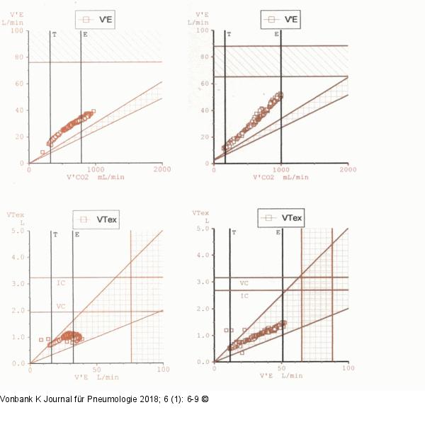 Ventilatorische Limitierung
