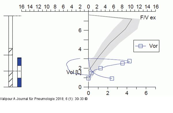 Spirometrie  