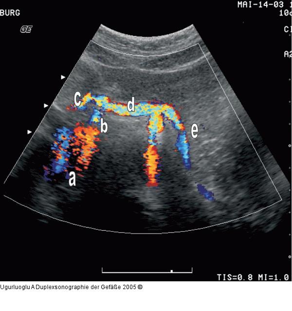 Duplexsonographie - T. coeliacus