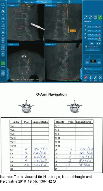 Schraubendimensionierung