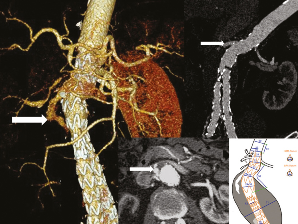 Produkt: E-ventus® <br>Vertrieb: Jotec GmbH