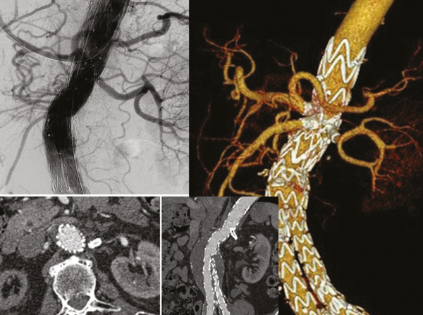 Produkt: E-ventus®<br>Vertrieb: Jotec GmbH