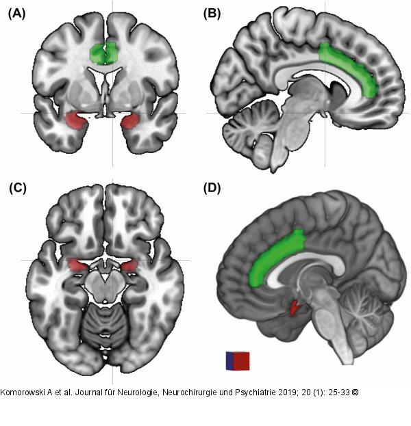 „Christmas tree phenomenon“