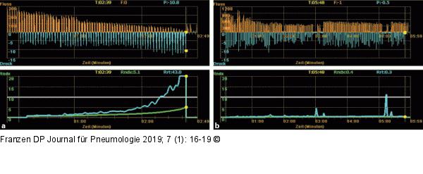Bronchoskopische Messung