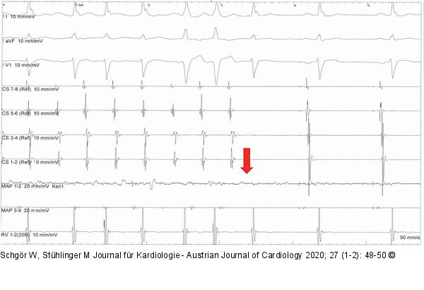 Elektroanatomisches Mapping