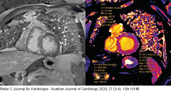 Magnetresonanztomographie