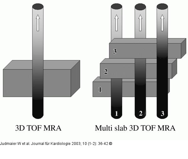 3D-Time of Flight-Magnetresonanzangiographie