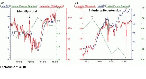Therapeutische Interventionen