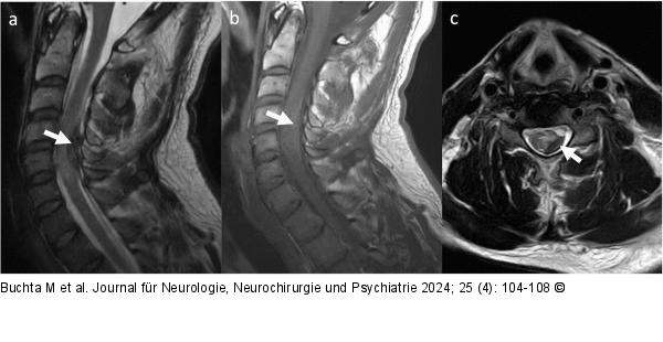 Präoperative MRT-Bilder