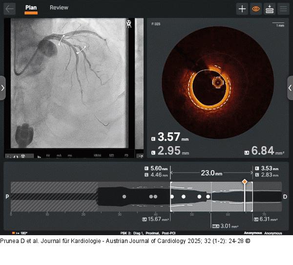 Proximaler D-Referenzdiameter