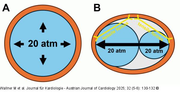 Buddy balloon technique