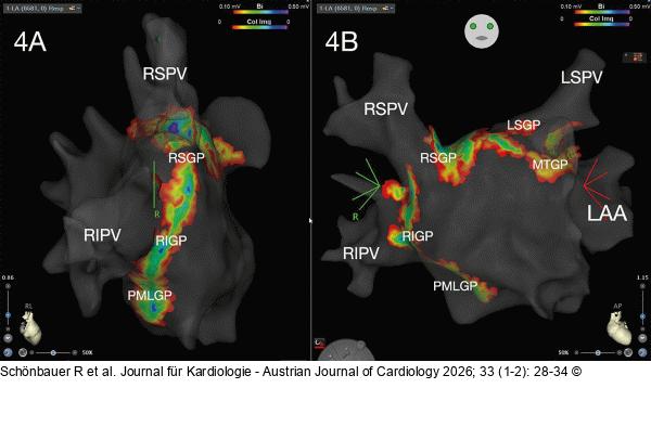 Elektroanatomisches Mapping